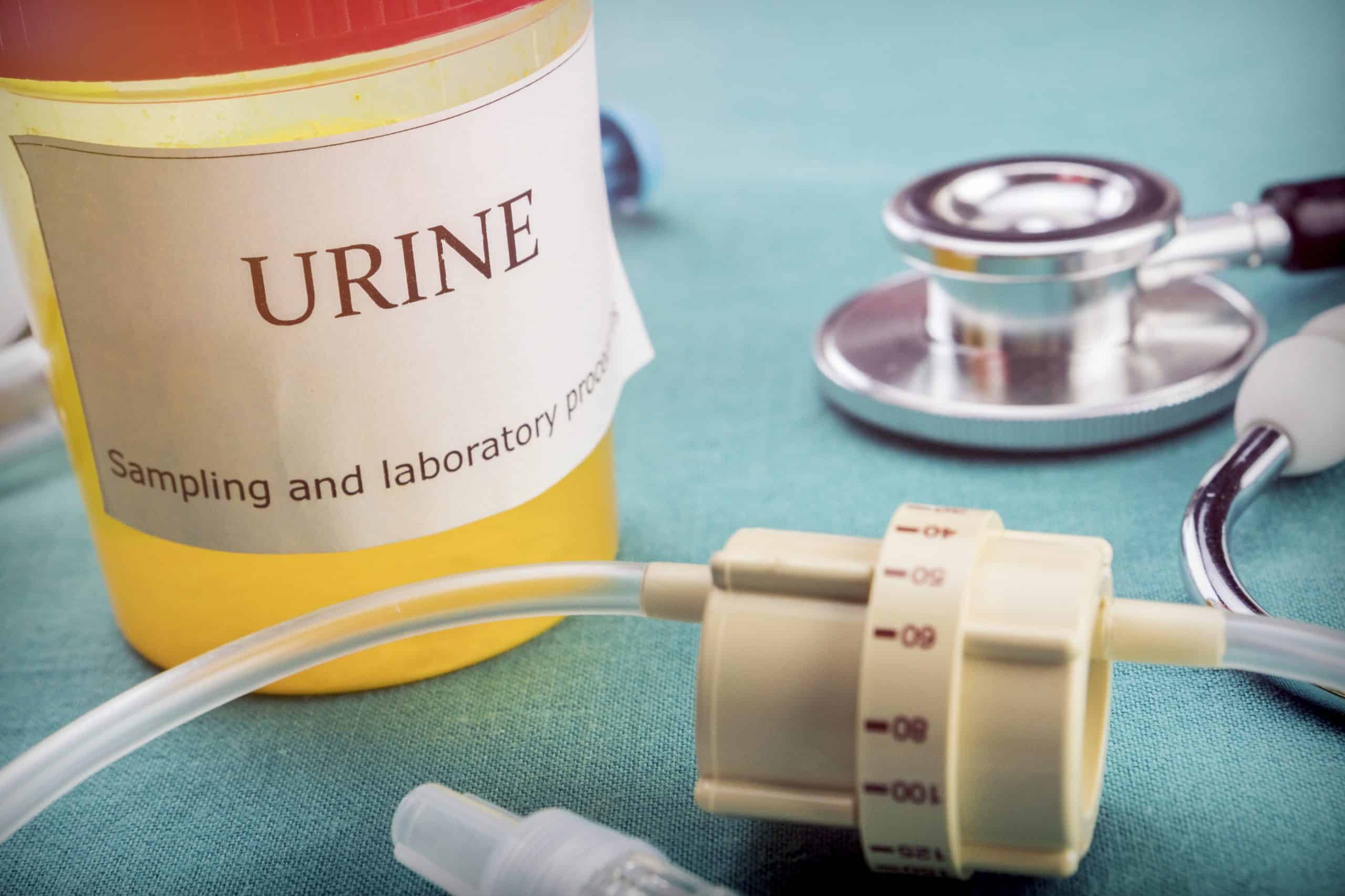 Drug Addiction Test