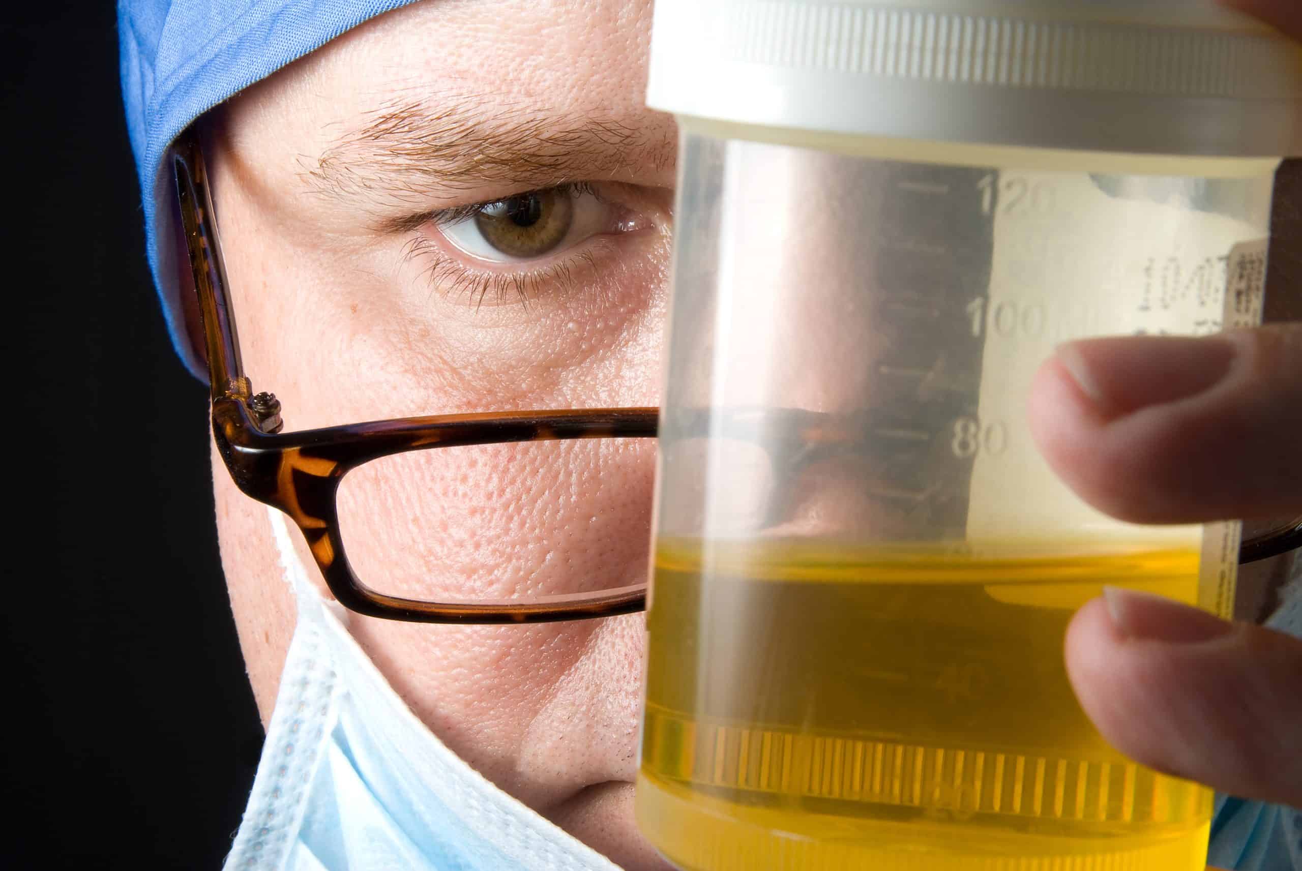 Drug Addiction Test