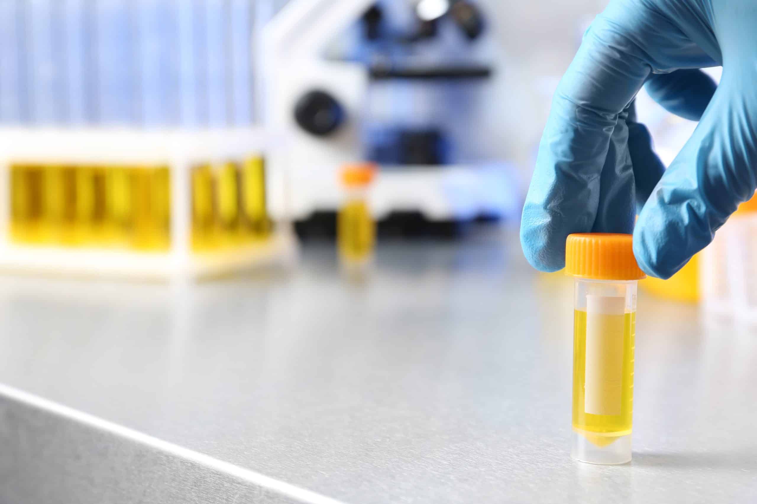 Drug Addiction Test