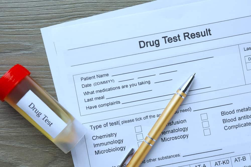 Kratom urine drug test result form